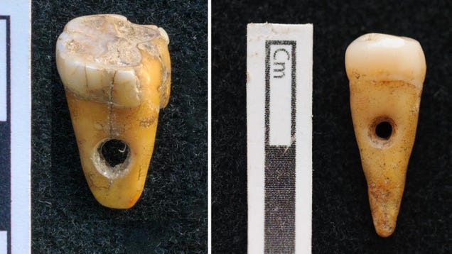 Prehistoric Turks Wore Human Teeth as Jewelry, Rare Discovery Reveals